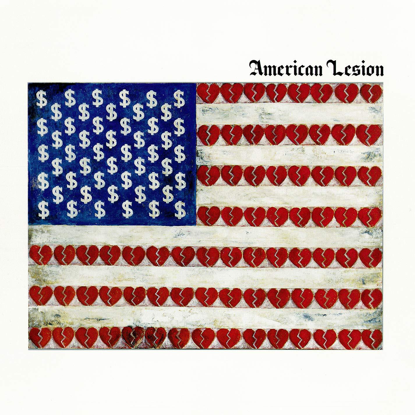 American Lesion (White Vinyl)