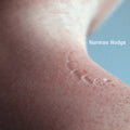 Embodiment EP