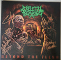BEYOND THE FLESH