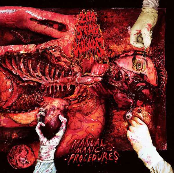 Manual Manic Prodcedures